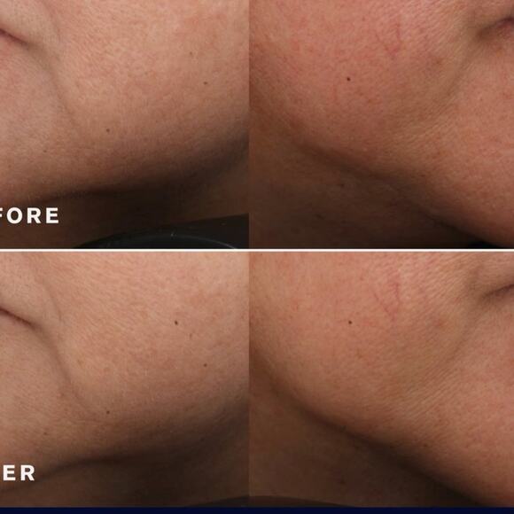 ESTEE LAUDER REVITALIZING SUPREME+ YOUTH POWER CREME 2.5 OZ - Picture 3 of 7